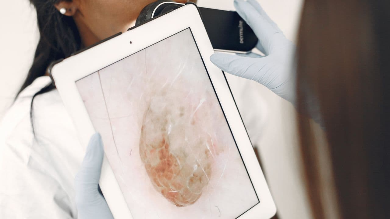 Dermatology care